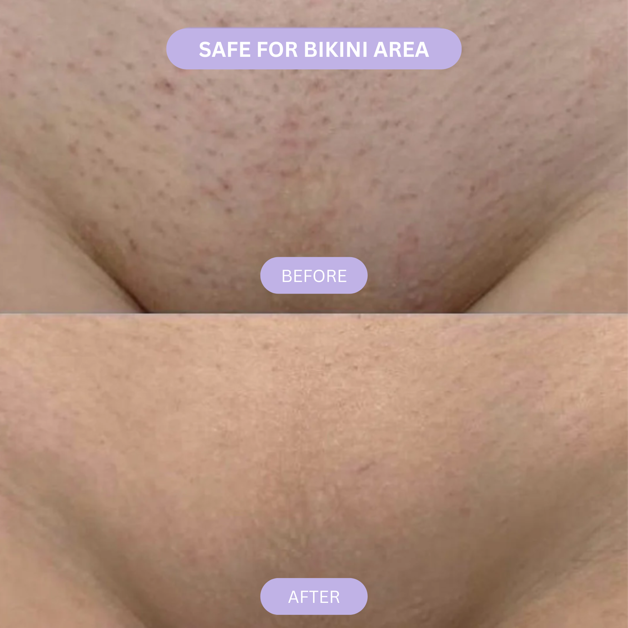 Lumitori Cyperus Rotundus Skin Serum